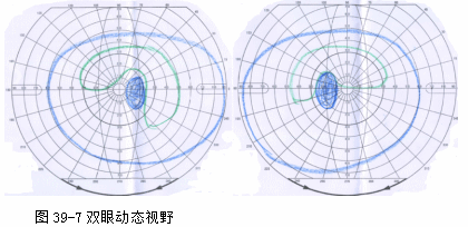 ZY016_212_3.gif